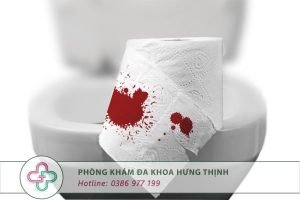 đi ngoài ra máu