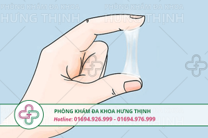Khí hư bất thường