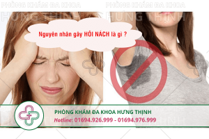 Nguyên nhân hôi nách