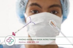 tháo vòng tránh thai