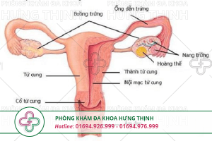 Viêm ống dẫn trứng
