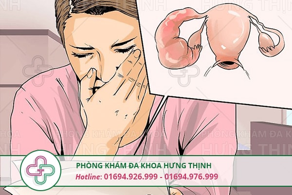 Triệu chứng viêm buồng trứng nữ giới cần biết