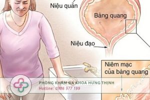 viêm niệu đạo
