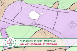 biểu hiện khí hư bất thường