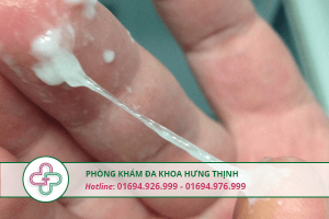 khí hư màu trắng sữa