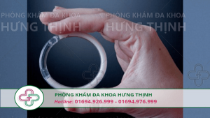 những điều cần biết về tháo vòng tránh thai
