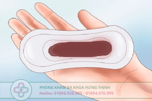 ra khí hư màu nâu