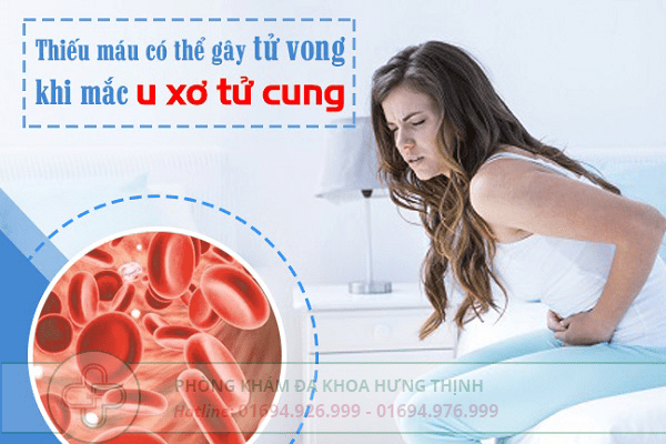 Bệnh u xơ tử cung có nguy hiểm không?