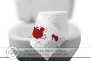 chảy máu hậu môn