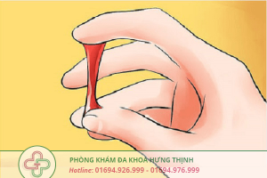 khí hư ra kèm máu