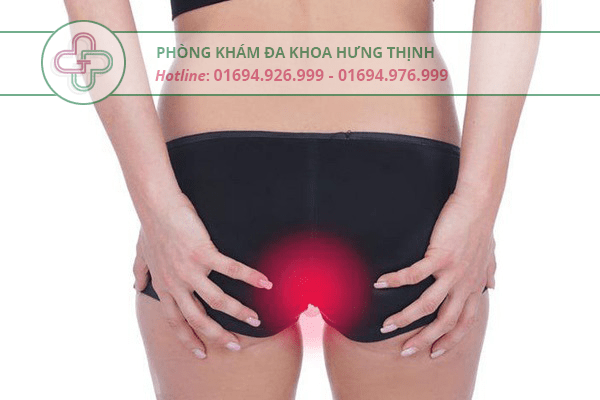 Triệu chứng của bệnh ngứa hậu môn