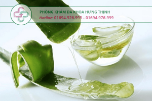 nha đam chữa mụn rộp sinh dục