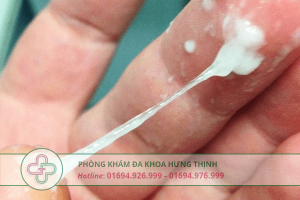 ra khií hư màu trắng đục