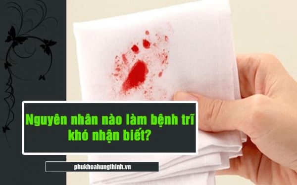 Nguyên nhân nào làm bệnh trĩ khó nhận biết?