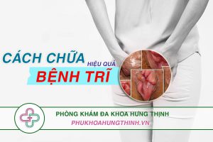 10 Cách chữa bệnh trĩ hiệu quả